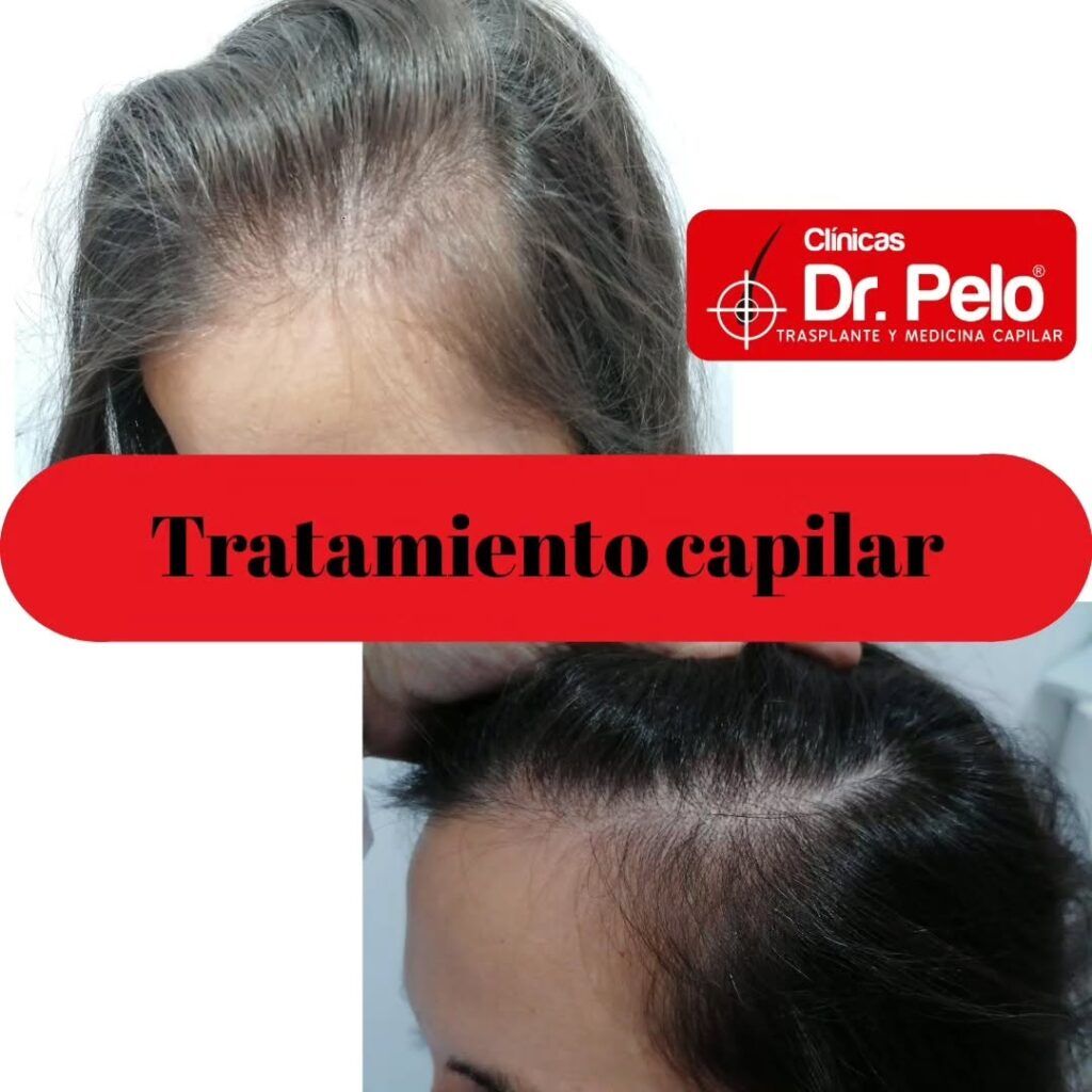 tratamiento-capilar-online-04