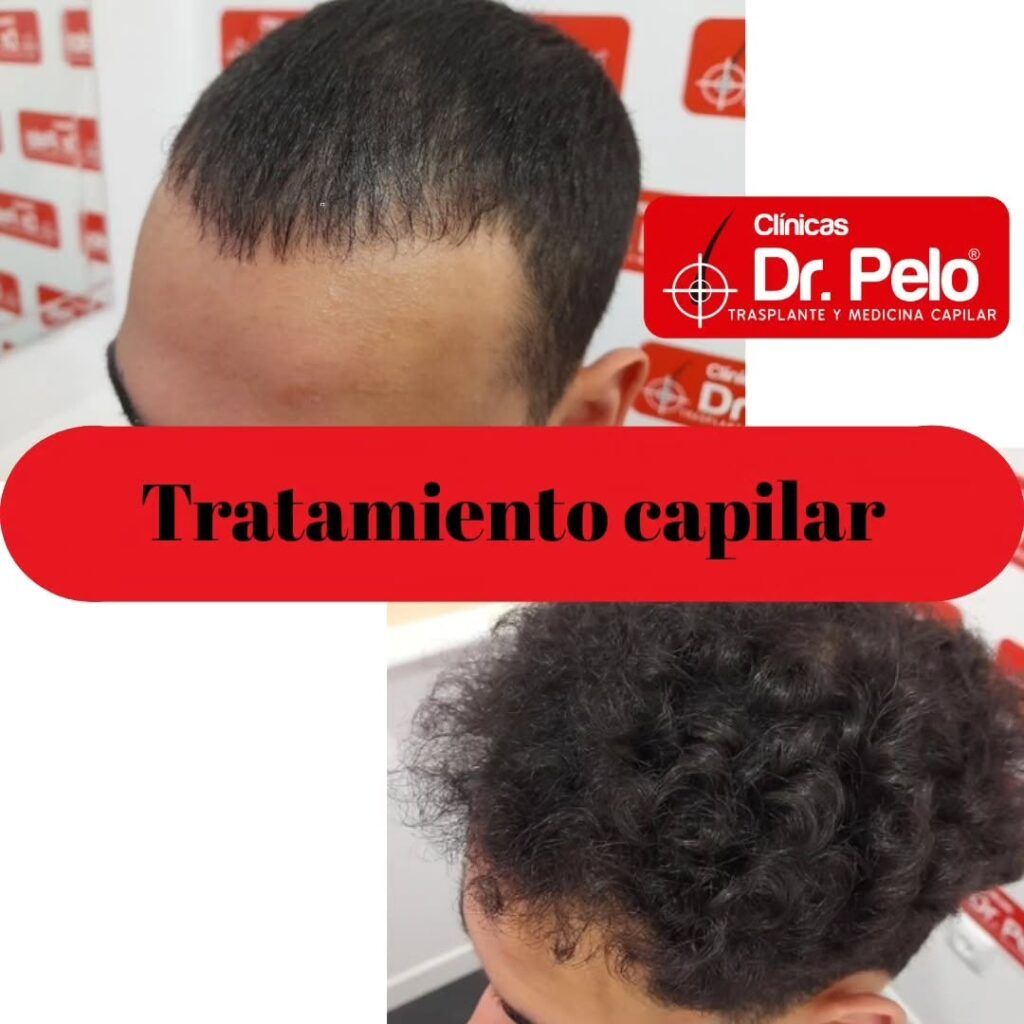 tratamiento-capilar-online-05