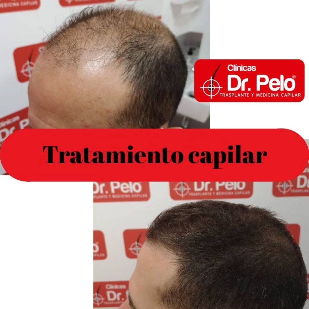 tratamiento-capilar-online-06