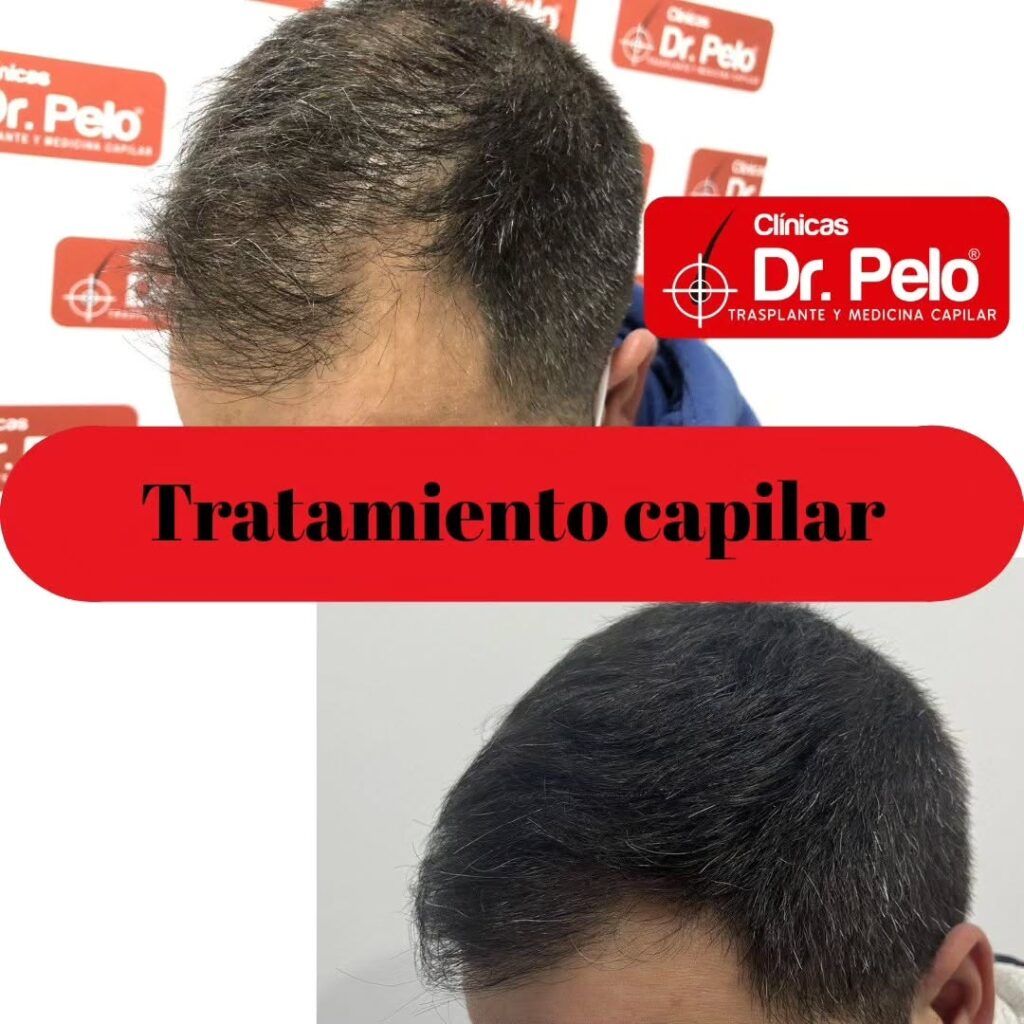 tratamiento-capilar-online-07