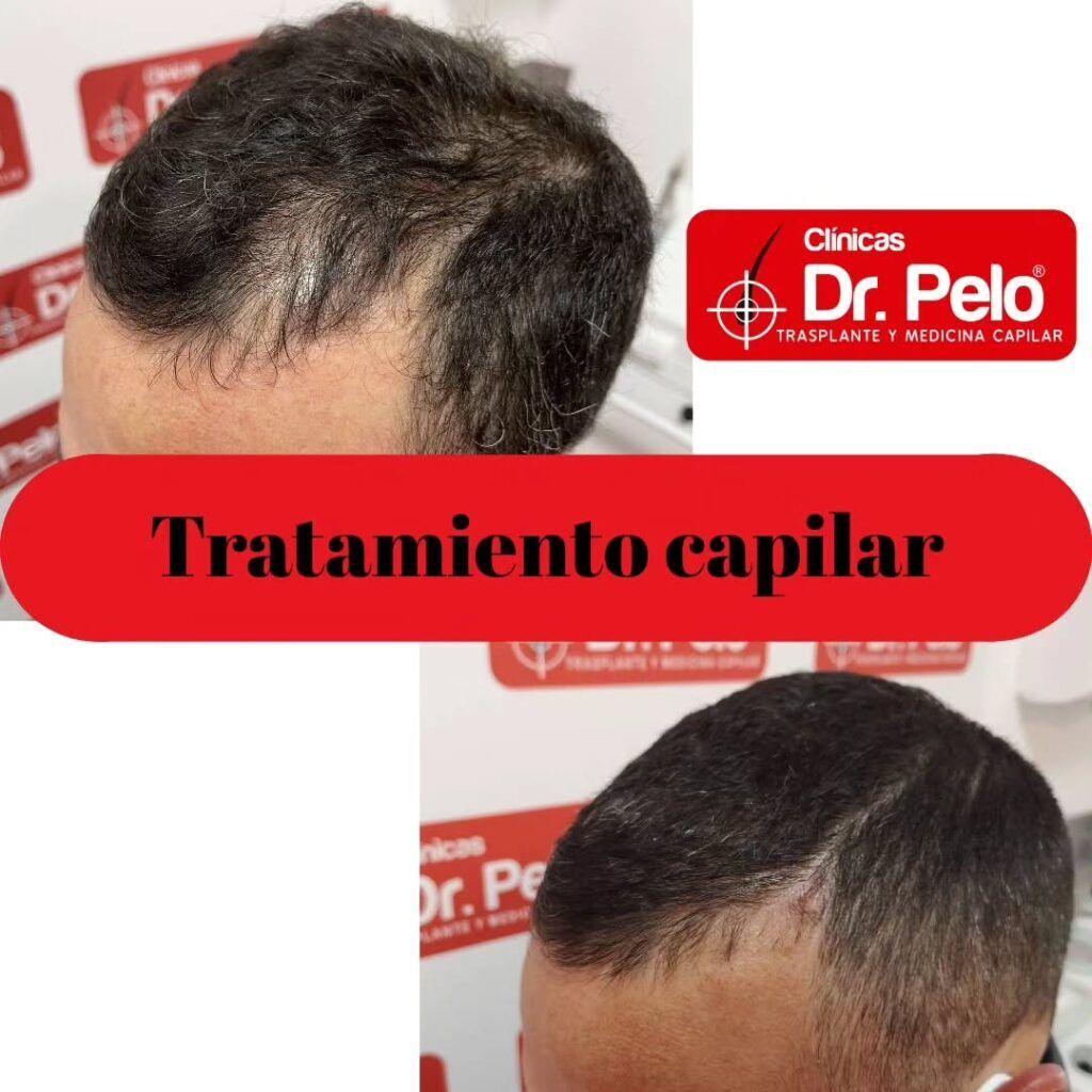 tratamiento-capilar-online-10