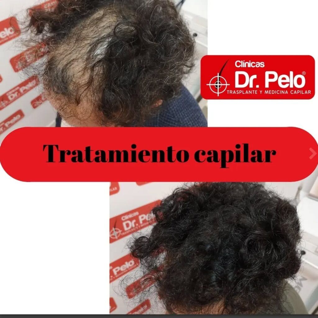 tratamiento-capilar-online-11