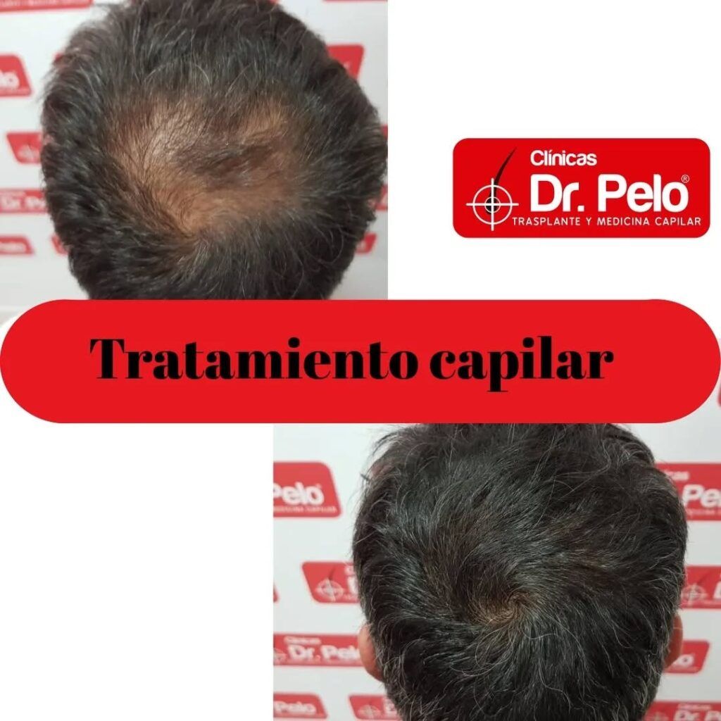 tratamiento-capilar-online-14