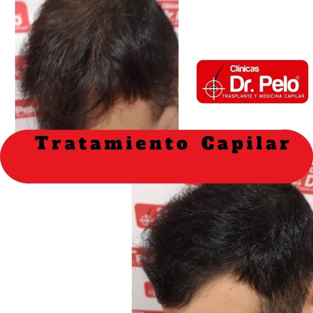 tratamiento-capilar-online-15