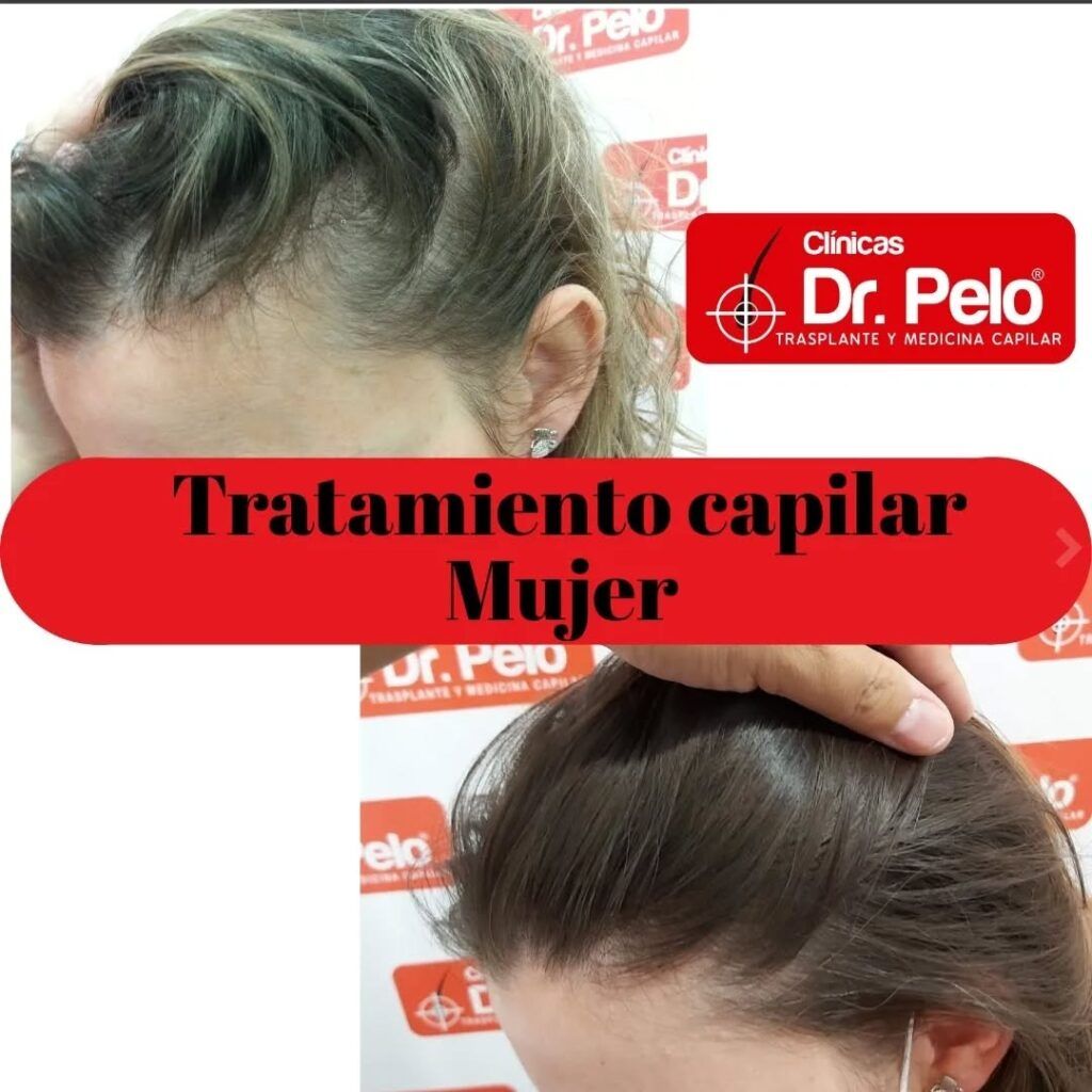 tratamiento-capilar-online-19