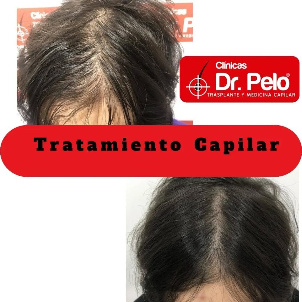 tratamiento-capilar-online-22