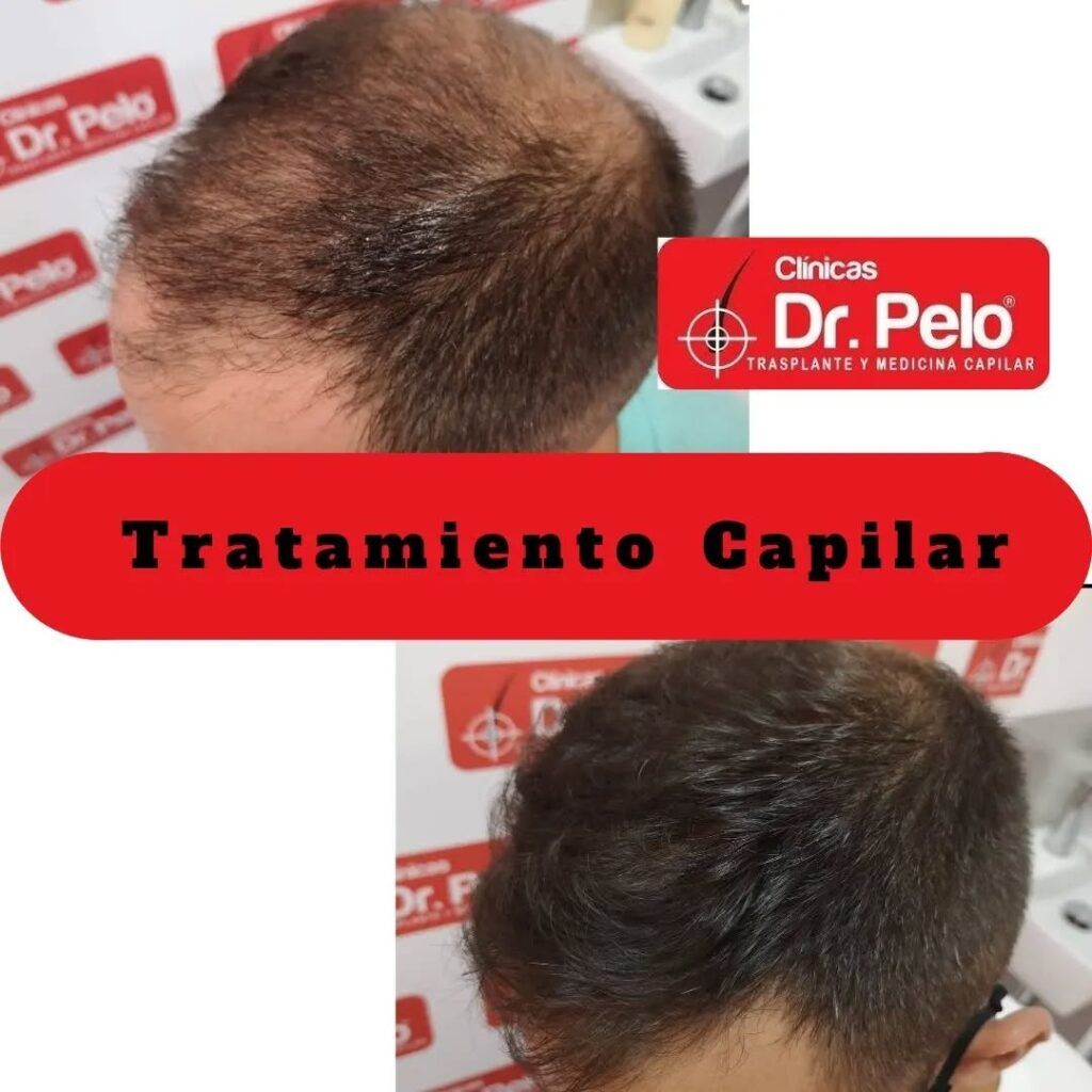 tratamiento-capilar-online-24