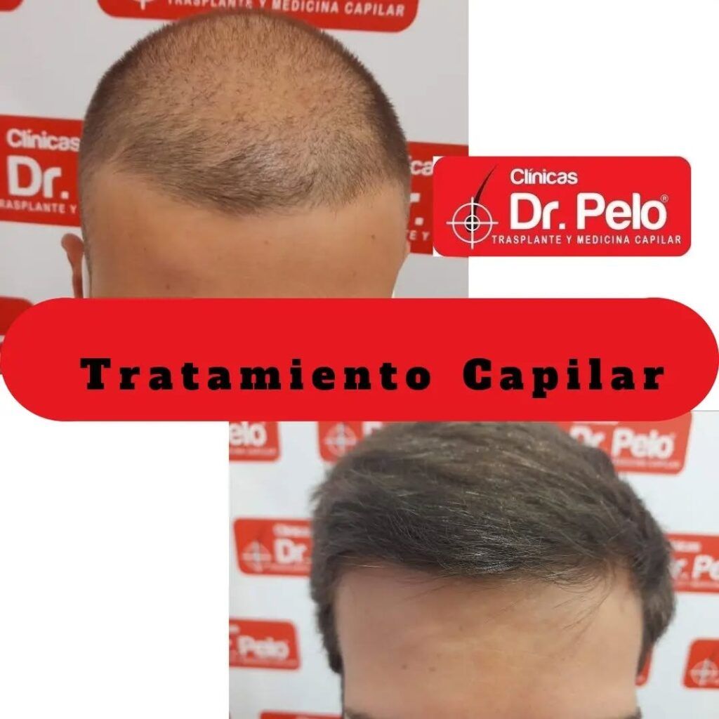 tratamiento-capilar-online-26