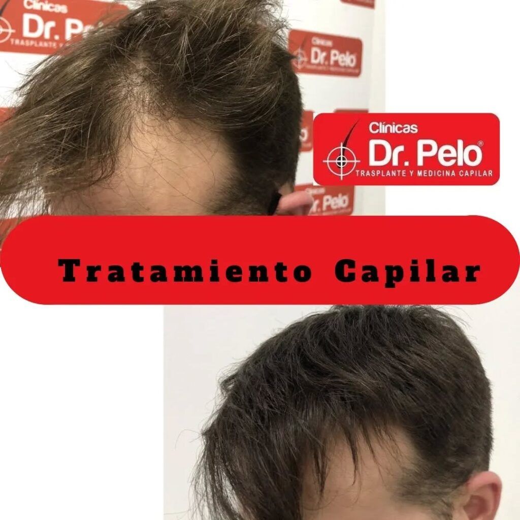 tratamiento-capilar-online-29