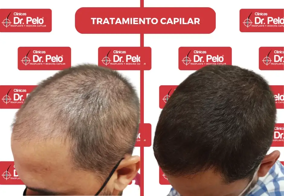 clinica-medicina-capilar.webp