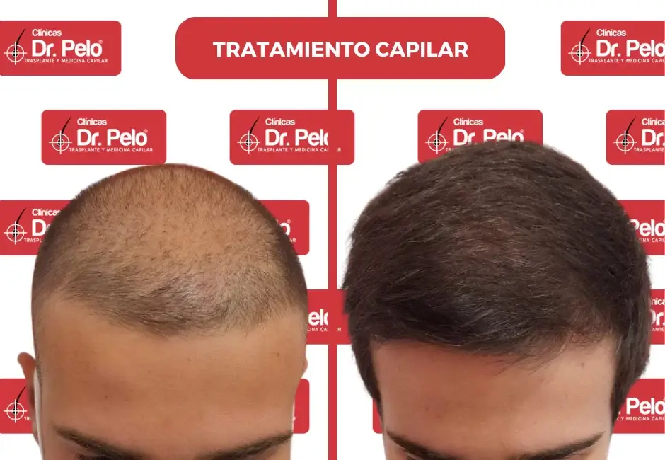 medicina-capilar.webp